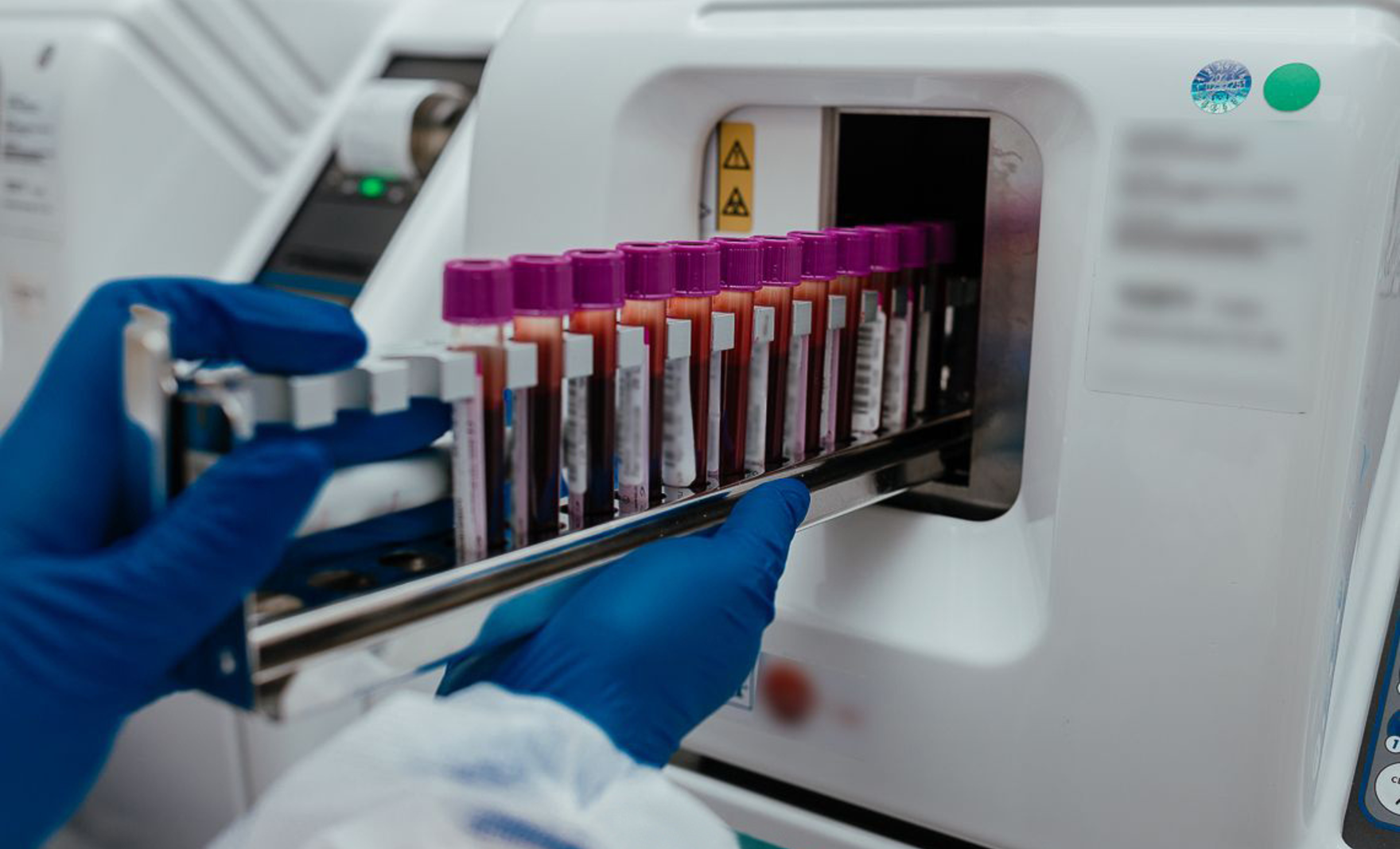 Как подготовить организм к осенне-зимнему периоду: советы экспертов лаборатории Helix